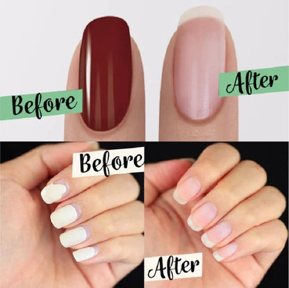 💅 Rimuovi Smalto Gel Magico 15 ml | Ammorbidisce e Solleva lo Smalto Gel in Circa 3 Minuti ⏱️ | Formula a Base d'Acqua, Applicazione Mirata 💧 | Formato Tascabile per Casa e Viaggio 🧳 | Solo per Uso sulle Unghie ⚠️