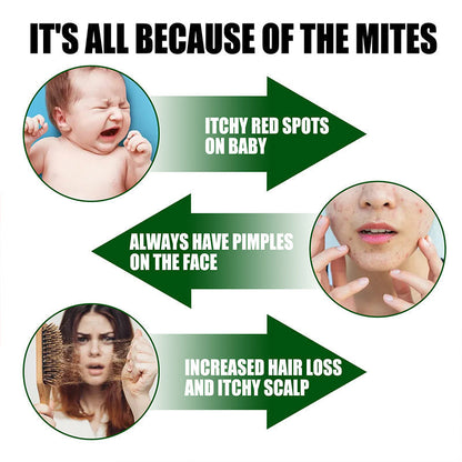 ⌛ Offerta Limitata -50% 🔥 Spray Potente Antiacaro