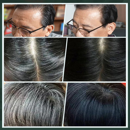 🥳2026 Hot Selling Item🥳💞 Over 50,000 units sold! 🌿🪥 50% Off! Plant-based comb-type hair dye—naturally deepens hair color. Gentle and chemical-free! 🌸✨
