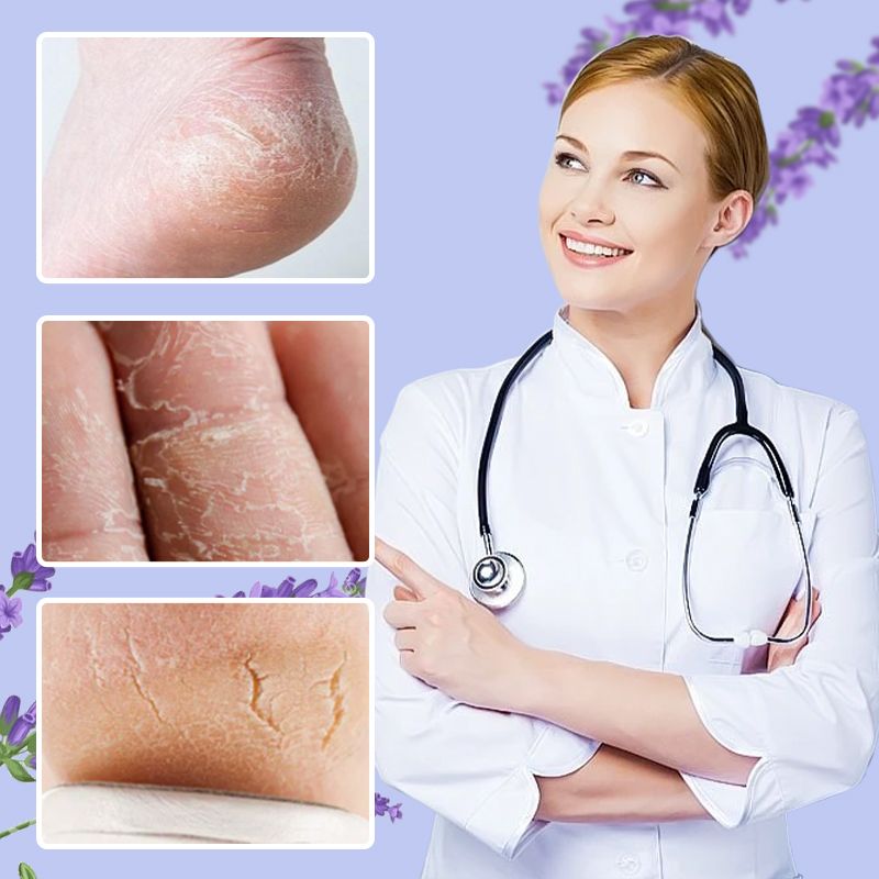 Balsamo Riparatore Nutriente Anti-Screpolature per i Piedi🌿💧