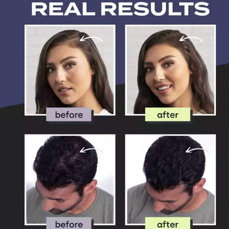 💇 Kit Fibre Capillari per Capelli Radi e Zone di Calvizie – 5 Colori, Resistente ad Acqua & Sudore, Risultato Naturale Immediato ✨