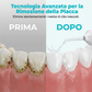 Idropulsore dentale portatile senza fili