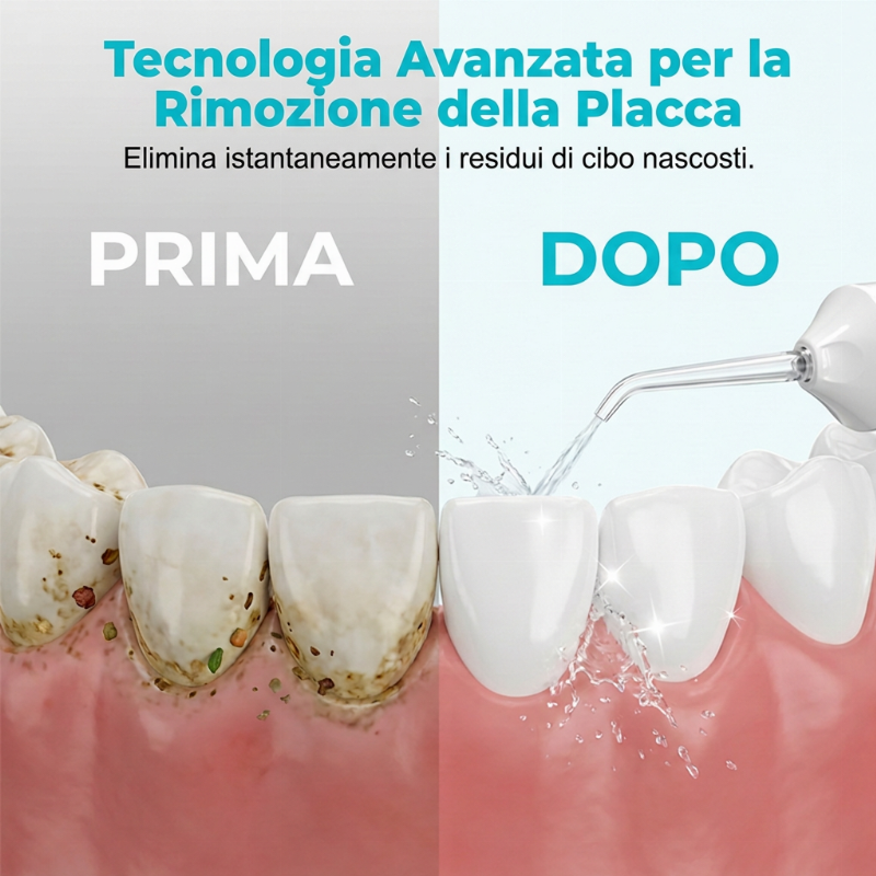 Idropulsore dentale portatile senza fili