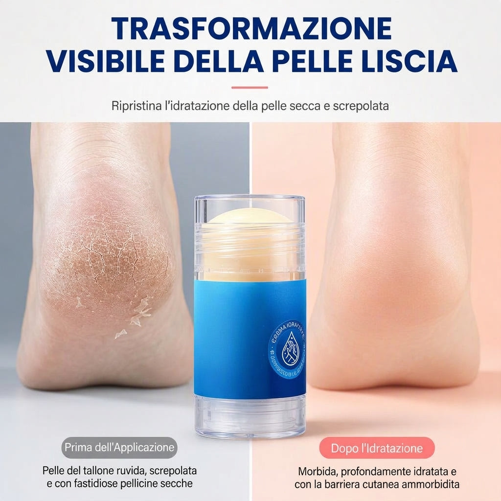 Bastone di Vaselina Idratante per Estremità e Piedi Secchi